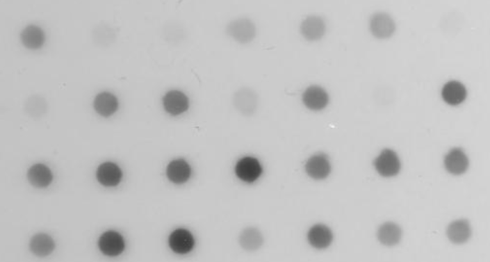  (https://rsbweb.nih.gov/ij/docs/examples/dot-blot) The result of blotting can be a dot blot. 